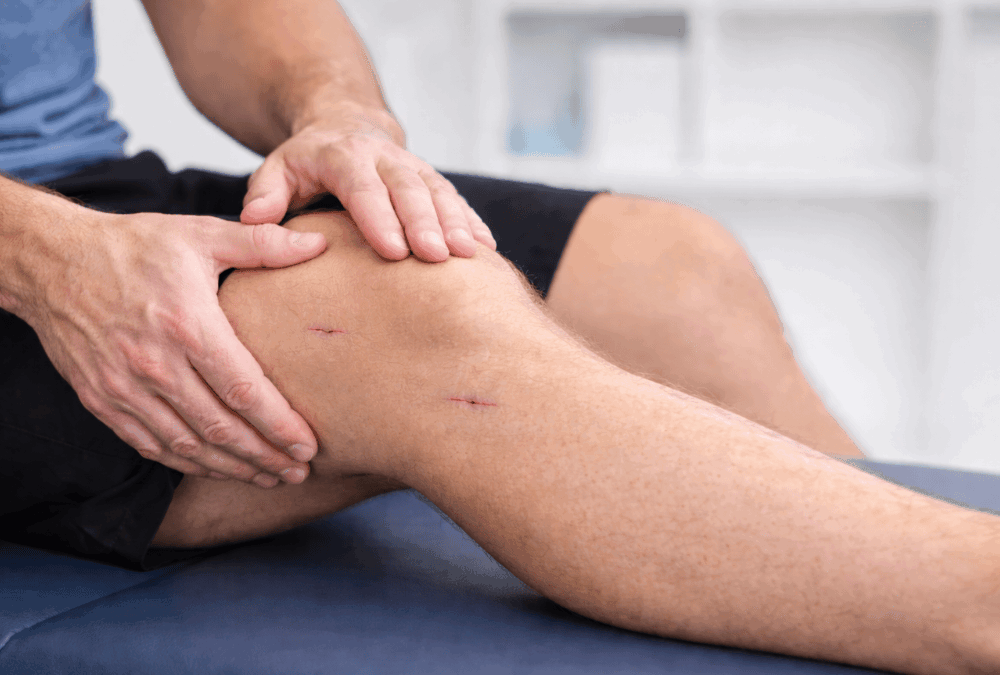 Riabilitazione del LCA: cosa cambia tra percorso conservativo e post-operatorio
