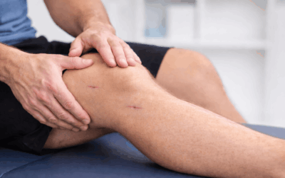 Riabilitazione del LCA: cosa cambia tra percorso conservativo e post-operatorio