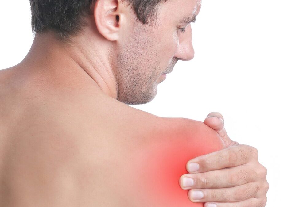 Capsulite adesiva: le fasi della spalla congelata e i tempi reali di recupero